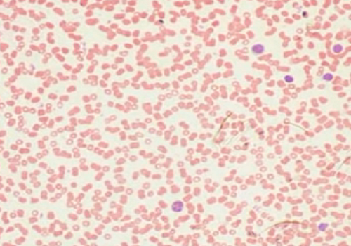 Базофильные лейкоциты